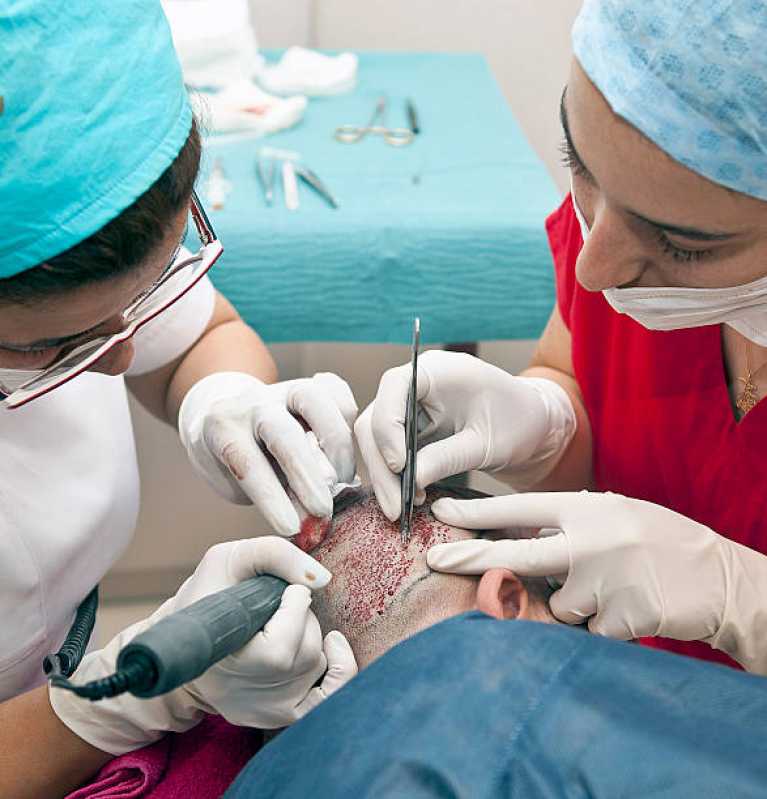 Cirurgia de Implante Capilar na Testa Valores Ferraz de Vasconcelos - Cirurgia Capilar Fue