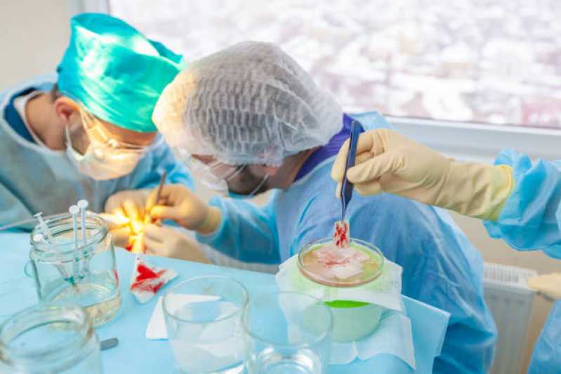 Clínica de Implante Capilar em Mulher Bela Vista de Goiás - Clínica de Implante Capilar Masculino