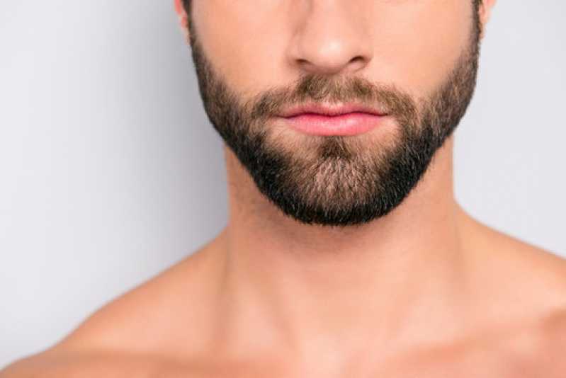 Clínica de Implante Capilar para Barba Rala Telefone Mongaguá - Clínica de Implante na Barba