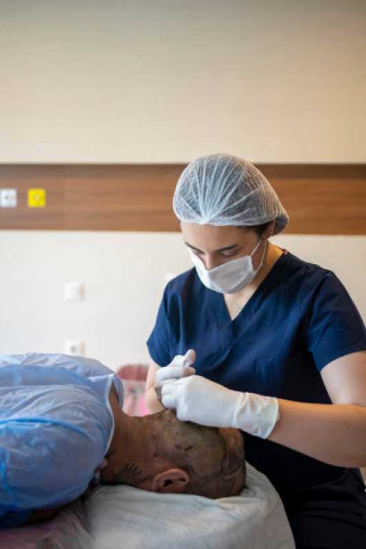 Clínica de Transplante Capilar Masculino Sudoeste de Goiás - Clínica de Transplante Capilar em Mulher