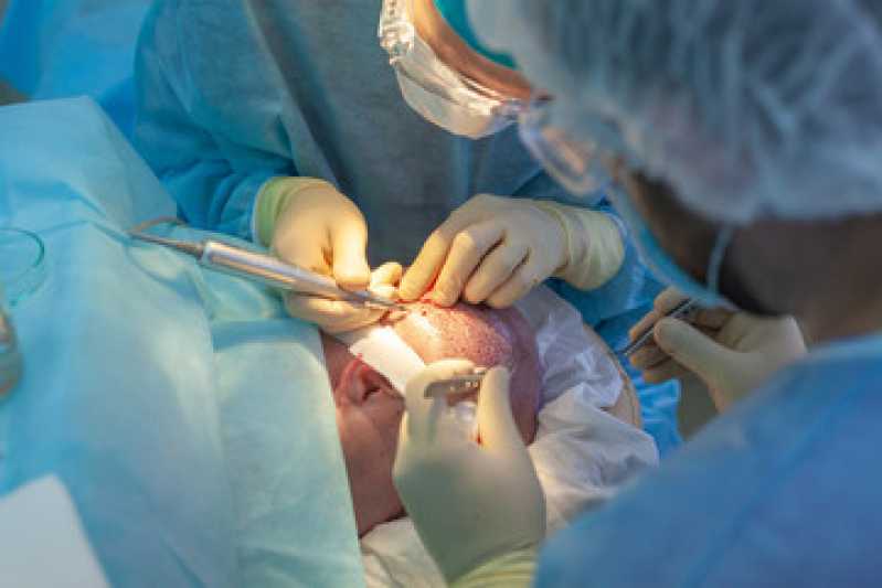 Clínica Especializada em Cirurgia de Transplante de Cabelo Samambaia - Cirurgia de Transplante de Cabelo Fia a Fio