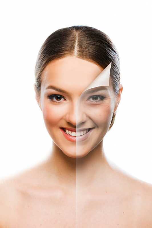 Clínica Especializada em Estética Facial para Mulheres Santa Maria - Estética Facial Botox