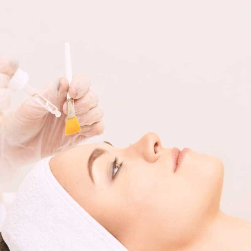 Clínica Especializada em Estética Facial para Rejuvenescimento Ourinhos - Estética Facial Peeling