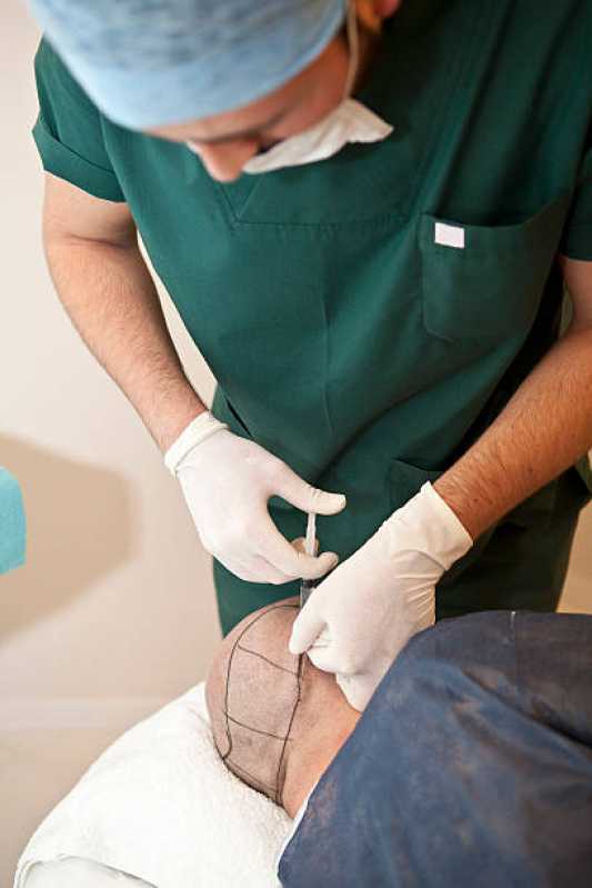 Clínica Especializada em Implante Cabelo Brazlândia - Implante Cabelo Masculino