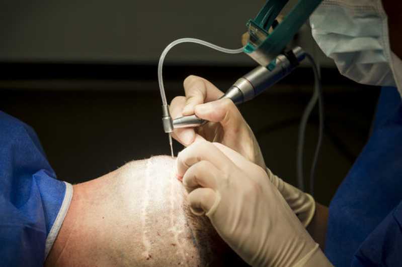 Clínica Especializada em Tratamento Cabelo Tatuapé - Tratamento para Cabelo
