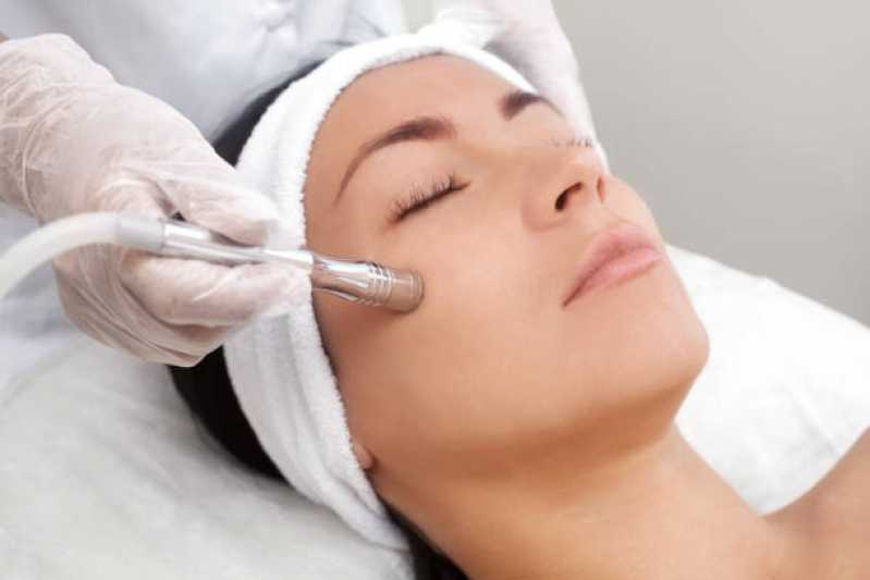 Clínica Especializada em Tratamento de Peeling Fenol Castanhal - Tratamento de Peeling para Poros Dilatados