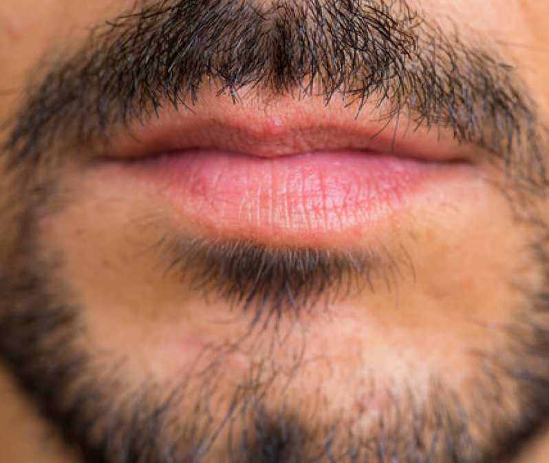 Endereço de Clínica de Implante Barba República - Clínica de Implante Capilar para Barba