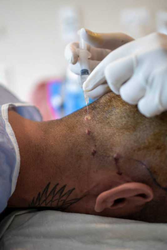 Endereço de Clínica de Tratamento Capilar Profissional Tatuapé - Clínica de Tratamento para Crescimento Capilar São Paulo