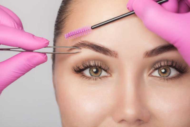 Implante Capilar na Sobrancelha Vila Mariana - Implante de pelos na Sobrancelha