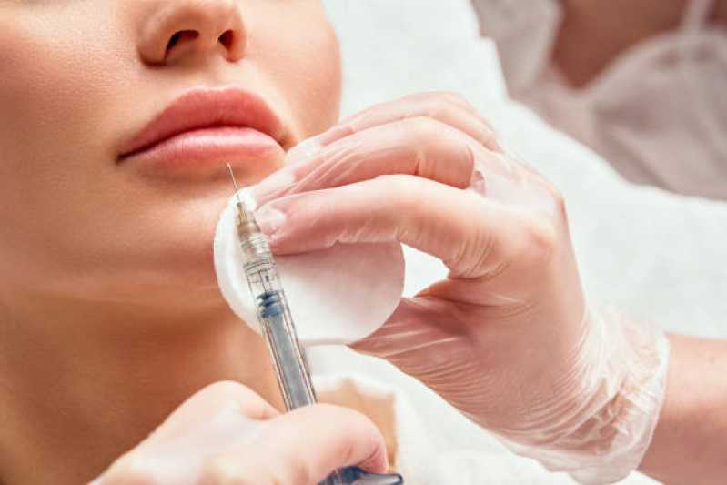 Onde Fazer Procedimento de Botox Boca Moema Índios - Procedimento de Botox nos Lábios