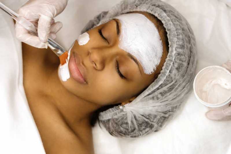 Onde Fazer Tratamento de Botox Facial Taubaté - Tratamento de Revitalização Facial