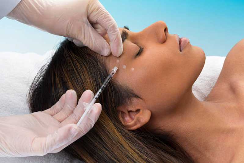 Onde Fazer Tratamento de Microagulhamento Facial Alto Paraíso - Tratamento de Botox Facial