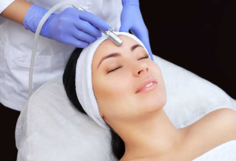 Onde Tem Tratamento de Botox Facial Tijuco Preto - Tratamento de Microagulhamento Facial