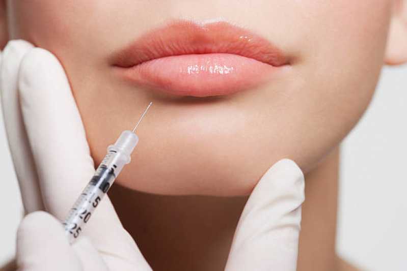 Procedimento de Botox Boca Preço Saúde - Procedimento de Botox Facial