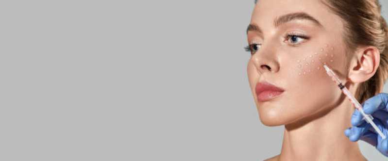 Procedimento de Botox Labial Vila Mariana - Procedimento de Botox nos Lábios