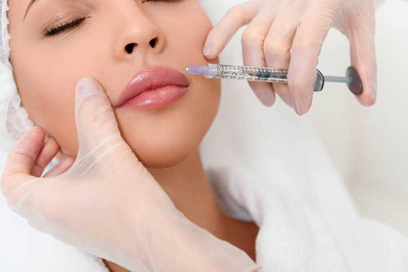 Procedimento de Botox na Boca Preço Indiara - Procedimento de Botox nos Lábios