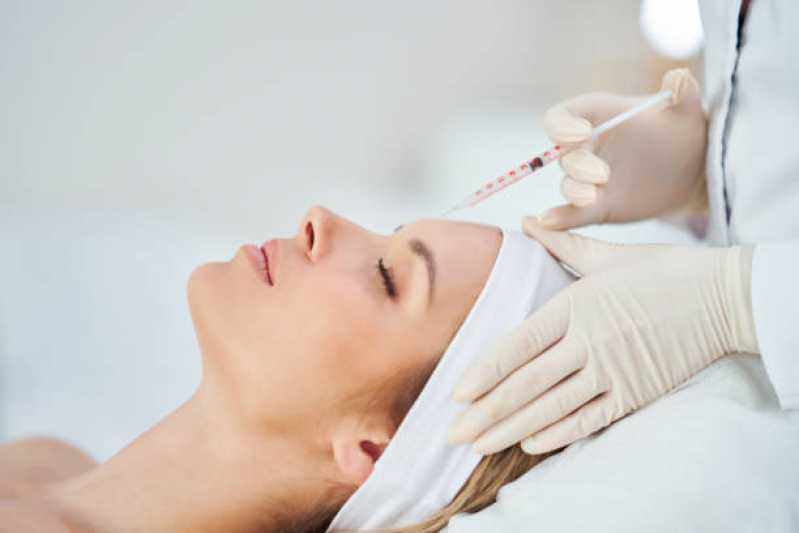 Procedimento de Botox na Testa Preço Pindamonhangaba - Procedimento de Botox nos Lábios
