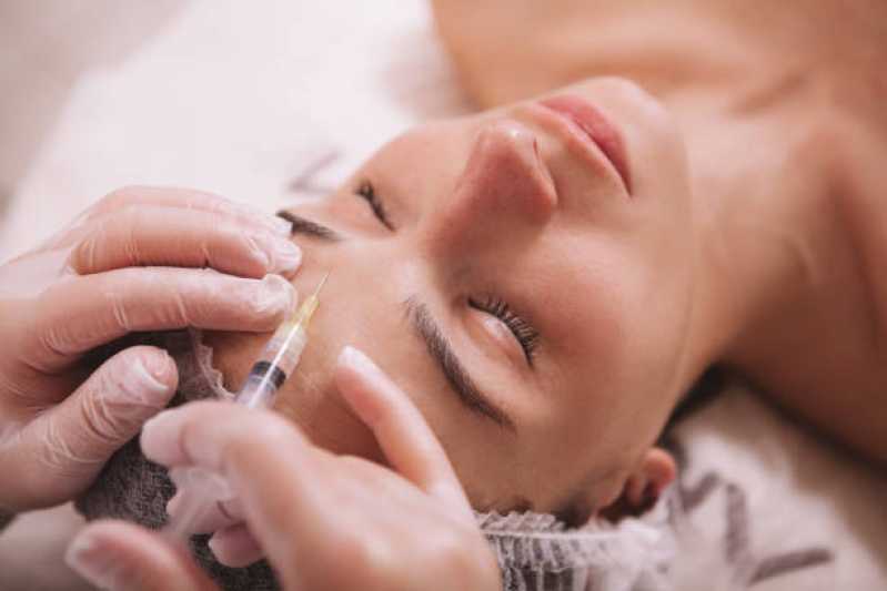 Procedimento de Botox na Testa Caldas Novas - Procedimento de Botox na Boca