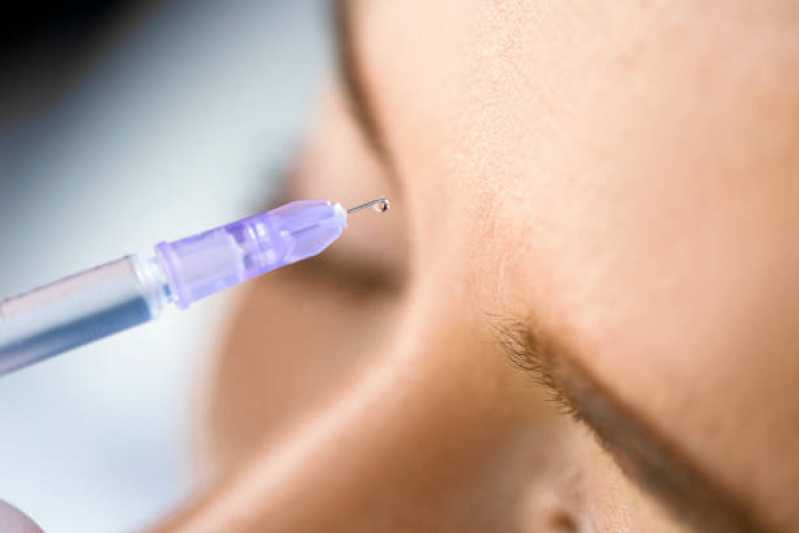Procedimento de Botox nas Axilas Preço Pires do Rio - Procedimento de Botox nas Pálpebras