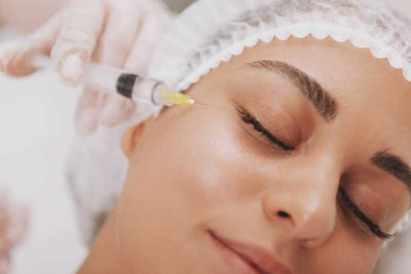 Qual o Valor de Procedimento de Botox na Testa Rio Quente - Procedimento de Botox nos Lábios