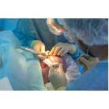 Cirurgia de Transplante de Cabelo