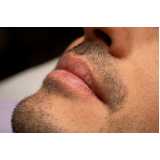 clínica de implante bigode Gurupi