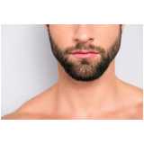 clínica de implante para barba telefone Gama