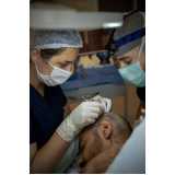 clínica de transplante capilar em homens Cavalcante
