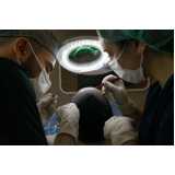 clínica de transplante capilar feminino na testa telefone Itapoã