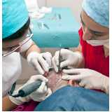 clínica especializada em cirurgia de implante capilar na testa Meia Ponte