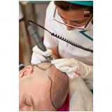 clinica especializada em tratamento capilar contato Piracanjuba
