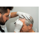 clínica implante cabelo telefone Vão do Paranã