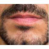 endereço de clínica de implante barba Goiandira