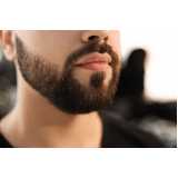 endereço de clínica de implante capilar para barba Scia