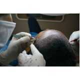 endereço de clínica para tratamento de cabelo Ibirapuera