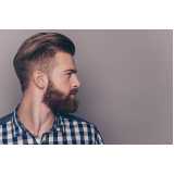 implante capilar para barba clínica Caierias
