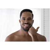 transplante capilar na barba Caieiras