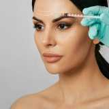 tratamento de microagulhamento facial Marabá