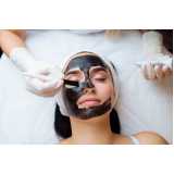 tratamento de preenchimento facial clínica São Vicente