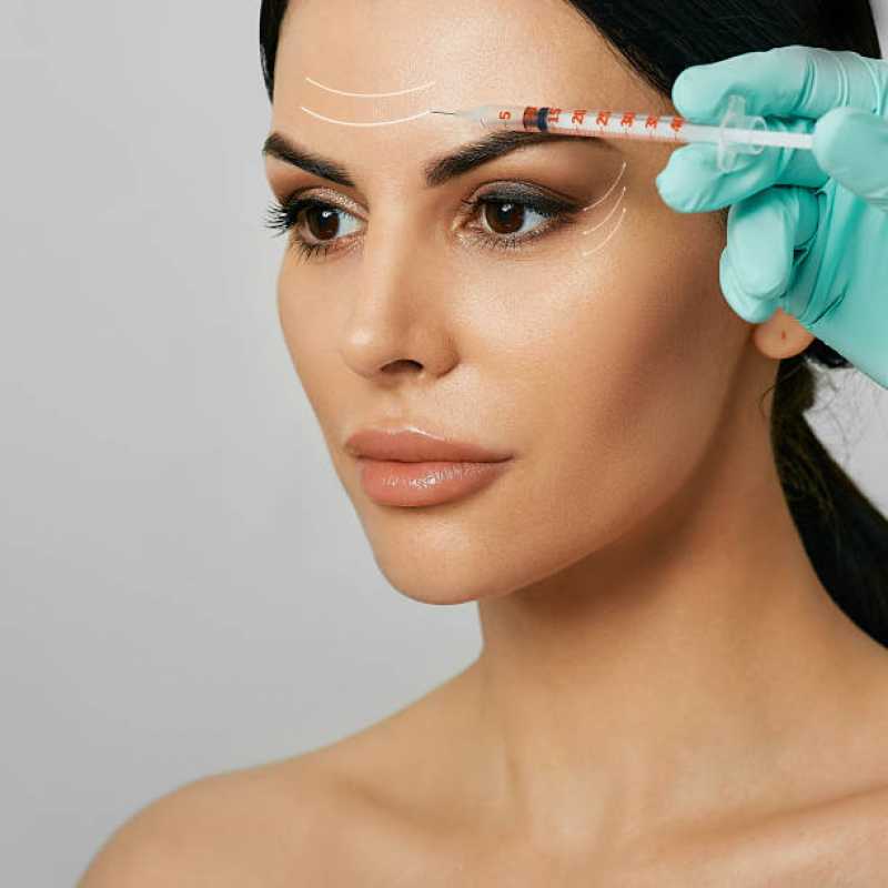Tratamento de Microagulhamento Facial Catalão - Tratamento de Peeling Facial