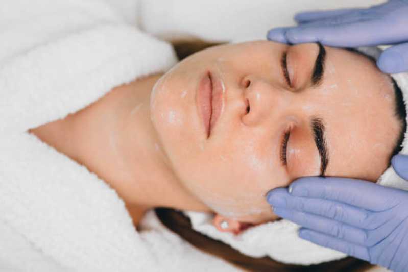 Tratamento de Peeling no Rosto Preço Vão do Paranã - Tratamento de Peeling para Poros Dilatados