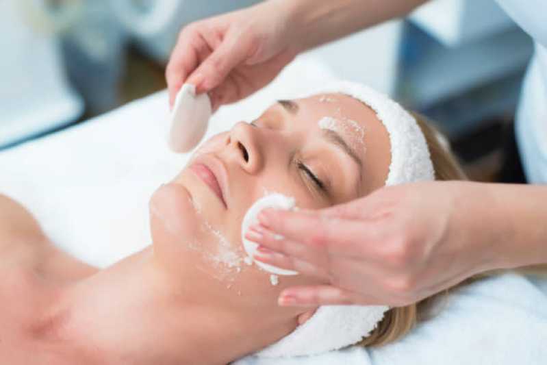 Tratamento de Peeling Olheiras Valores Tijuco Preto - Tratamento de Peeling para Poros Dilatados