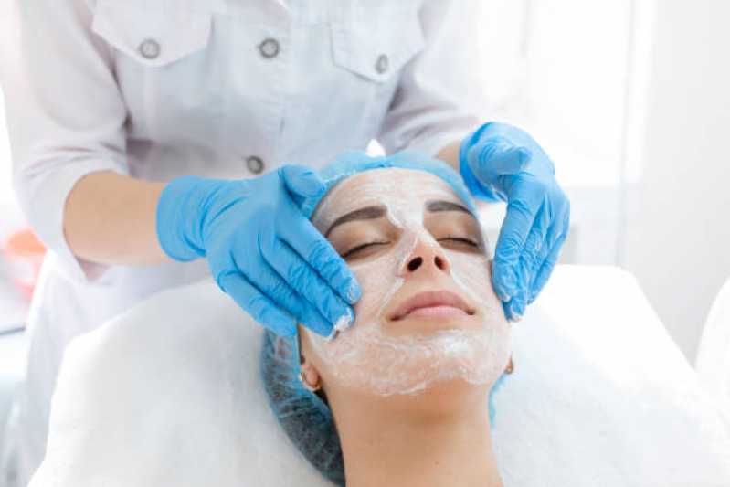 Tratamento de Peeling para Cicatriz de Acne Preço Brazlândia - Tratamento de Peeling para Poros Dilatados