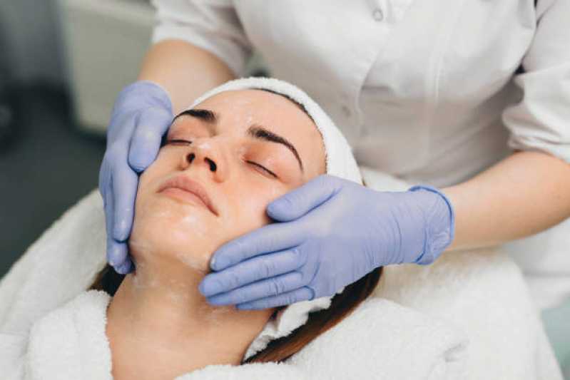 Tratamento de Peeling para Olheiras Preço Rialma - Tratamento de Peeling para Cicatriz de Acne