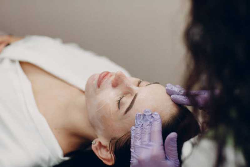 Tratamento de Peeling para Poros Dilatados Nerópolis - Tratamento de Peeling para Olheiras