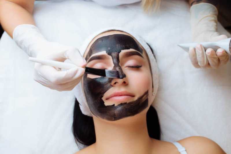 Tratamento de Preenchimento Facial Clínica Caldas Novas - Tratamento de Peeling Facial