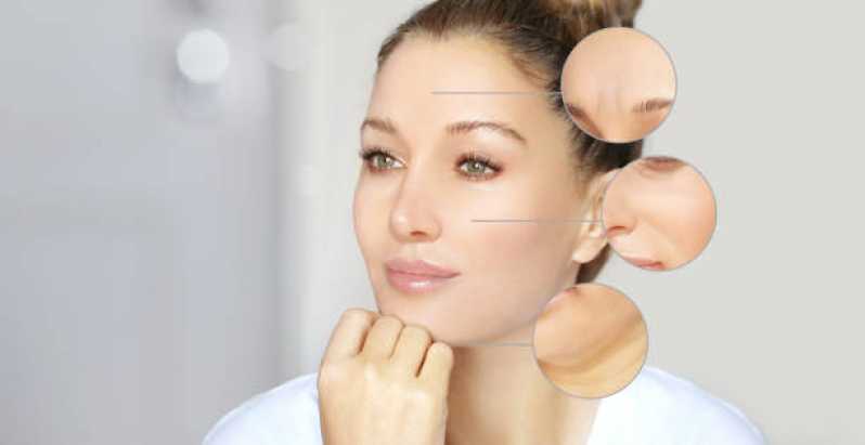 Tratamento para Flacidez do Rosto Clínica Pirenópolis - Tratamento de Peeling Facial
